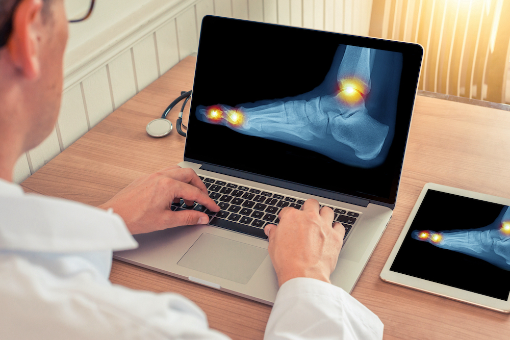 Doctor watching a laptop and digital tablet with x-ray of a foot with pain relief in the ankle and toes