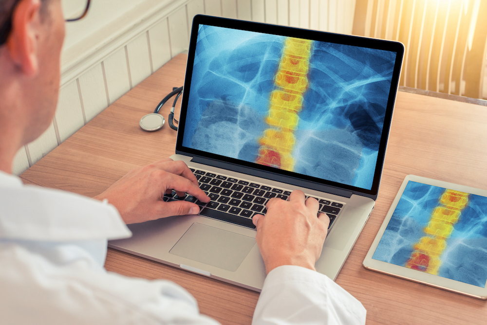 Doctor watching a laptop and digital tablet with x-ray of chest with pain relief on the spine