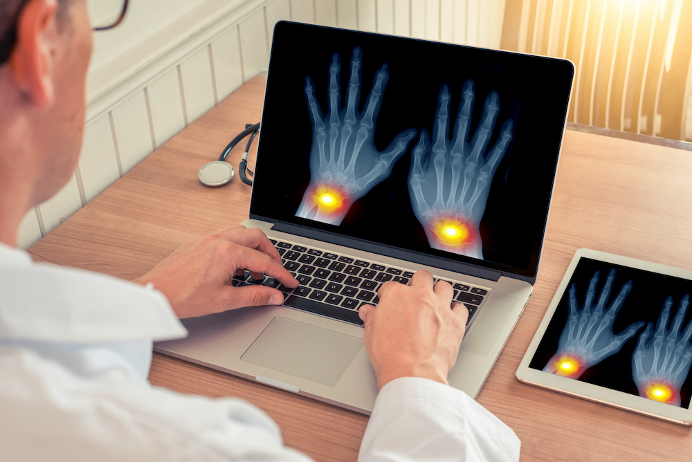 Doctor watching a laptop with x-ray of hands with pain relief in the wrists in a office. Osteoarthritis concept